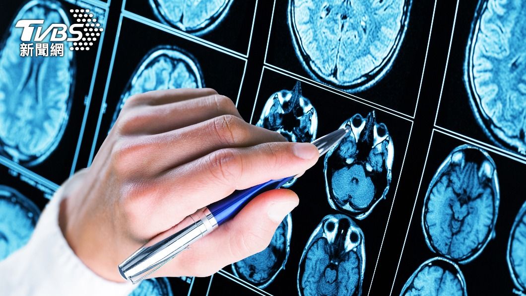 醫師指出,病人出血位置很靠近腦室,才讓他意識變差。(示意圖/shutterstock達志影像)