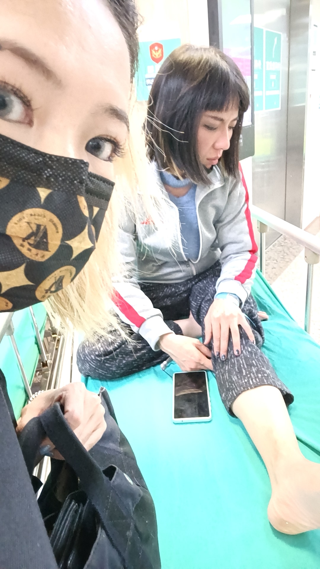 丫子不慎踩空導致骨裂。(圖/翻攝自Makiyo臉書)