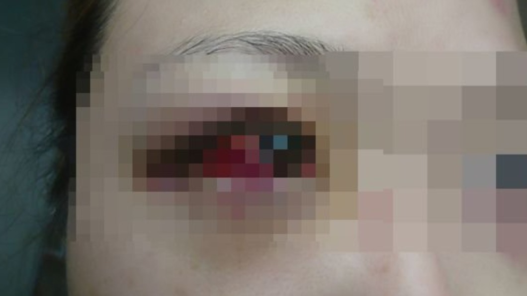 母子當「人肉沙包」2年!渣夫家族遭起底 連警察都怕