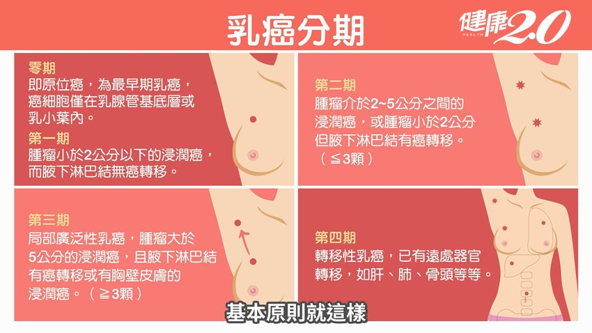  乳癌分期。（圖／TVBS）