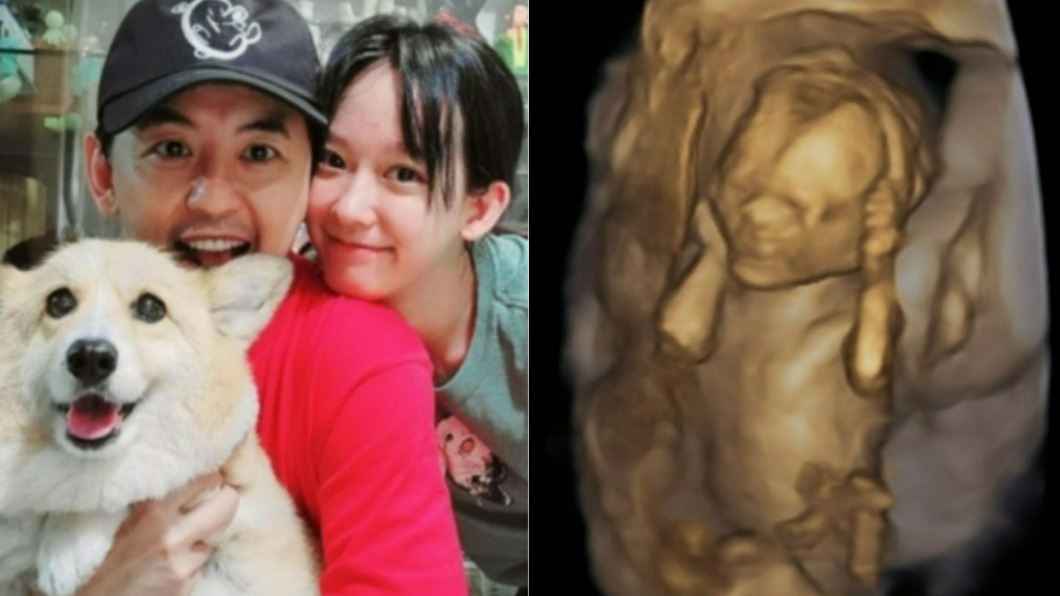 黃子佼曬「愛女超音波」驚見巧合 網刷愛心喊:回來了!
