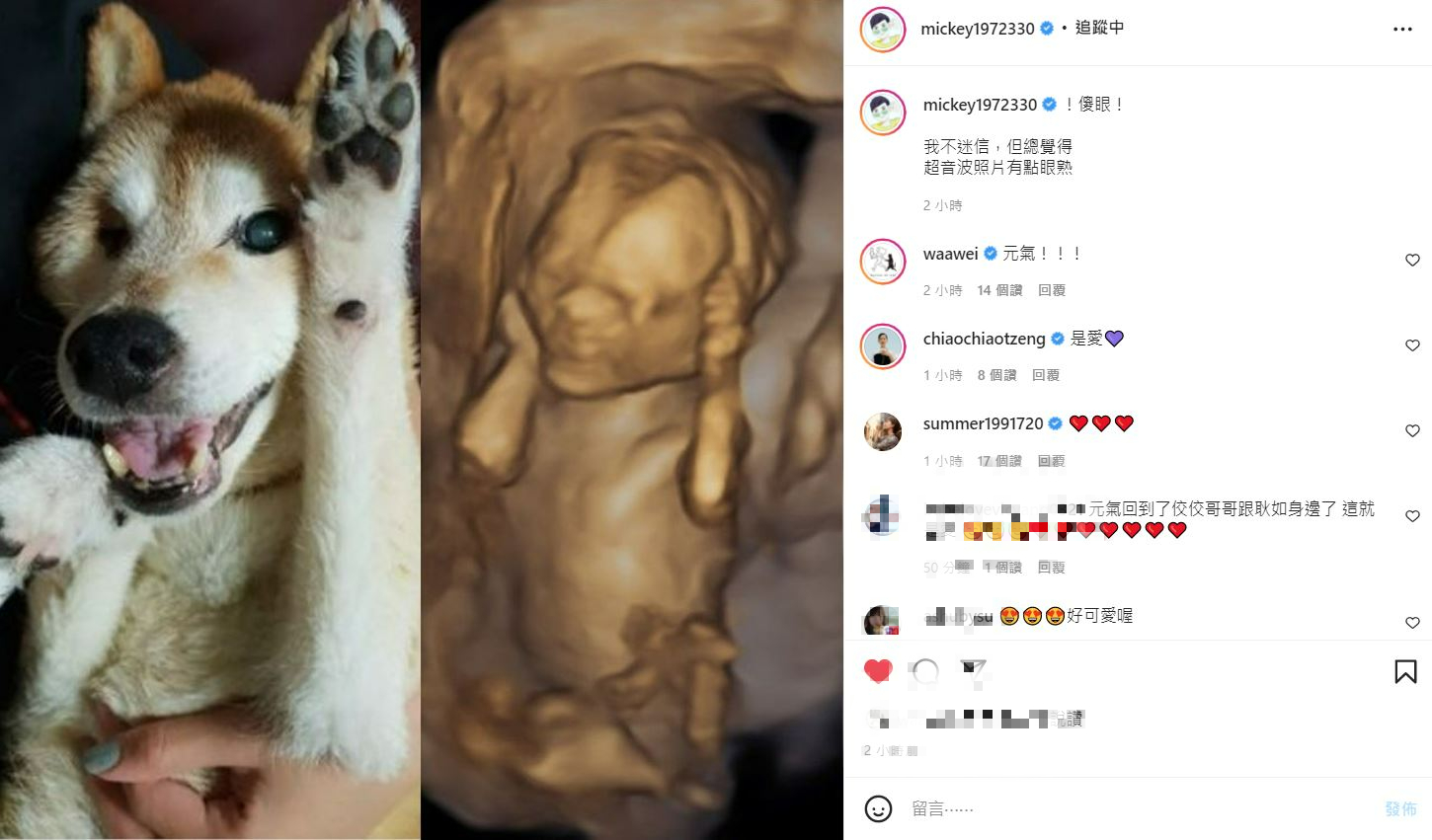 黃子佼女兒的超音波照片竟與已逝愛犬元氣相似度極高。（圖／翻攝自黃子佼IG）