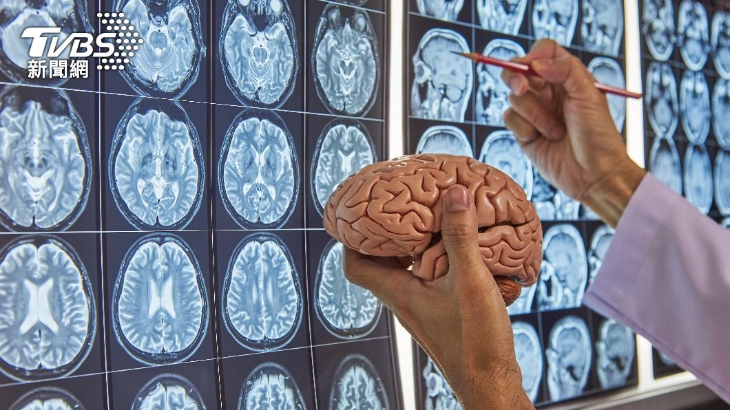 醫師指自戀是一種大腦病變。(示意圖/shutterstock 達志影像)