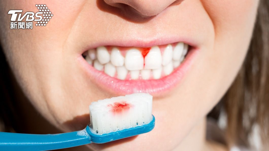 牙刷、漱口杯不換不洗,可能導致牙周病發生。(示意圖/shutterstock達志影像)