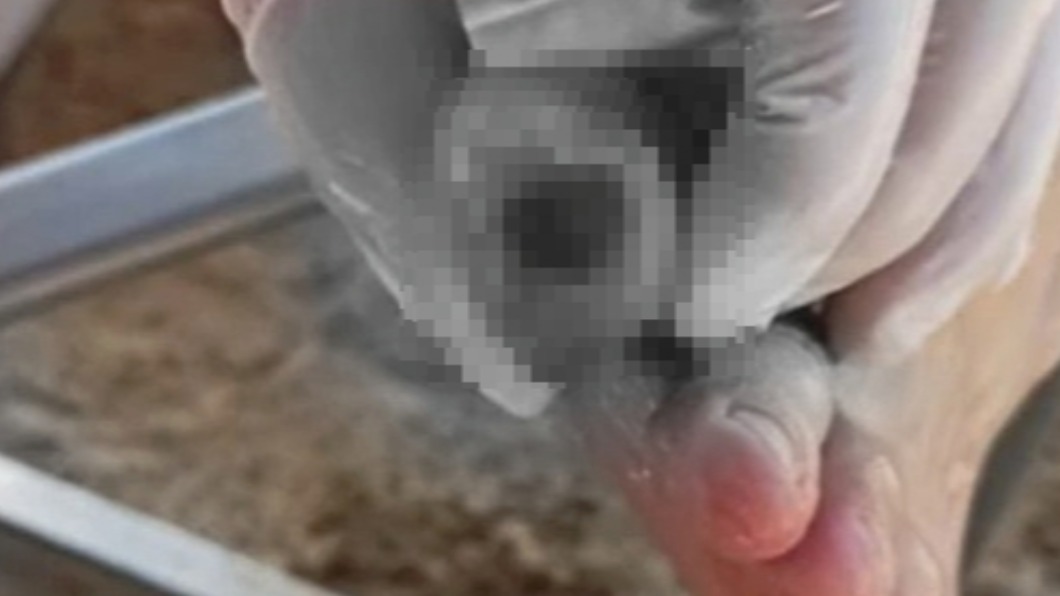 該名父親的腳趾頭被咬出一個洞。（圖／翻攝自《每日星報》官網）