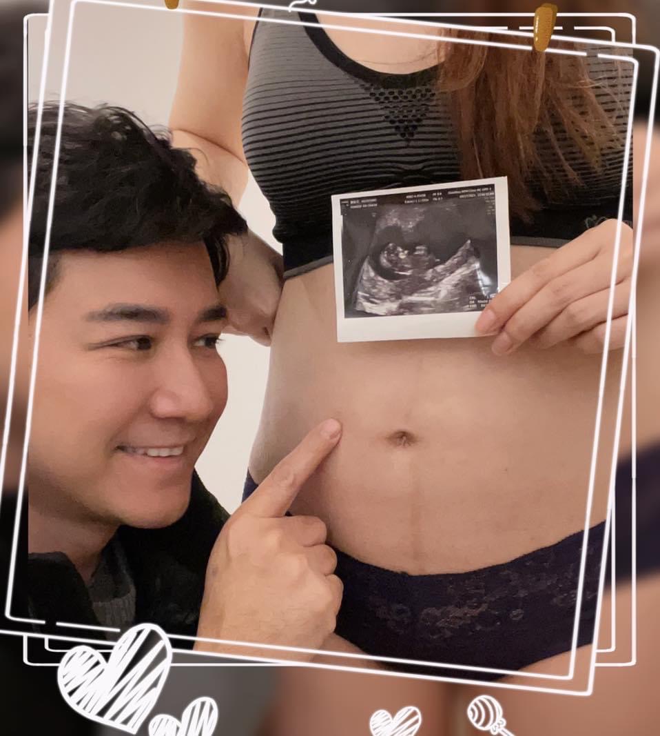 陳熙鋒先前曬出和老婆大肚及寶寶的超音波照片。（圖／翻攝自陳熙鋒臉書）