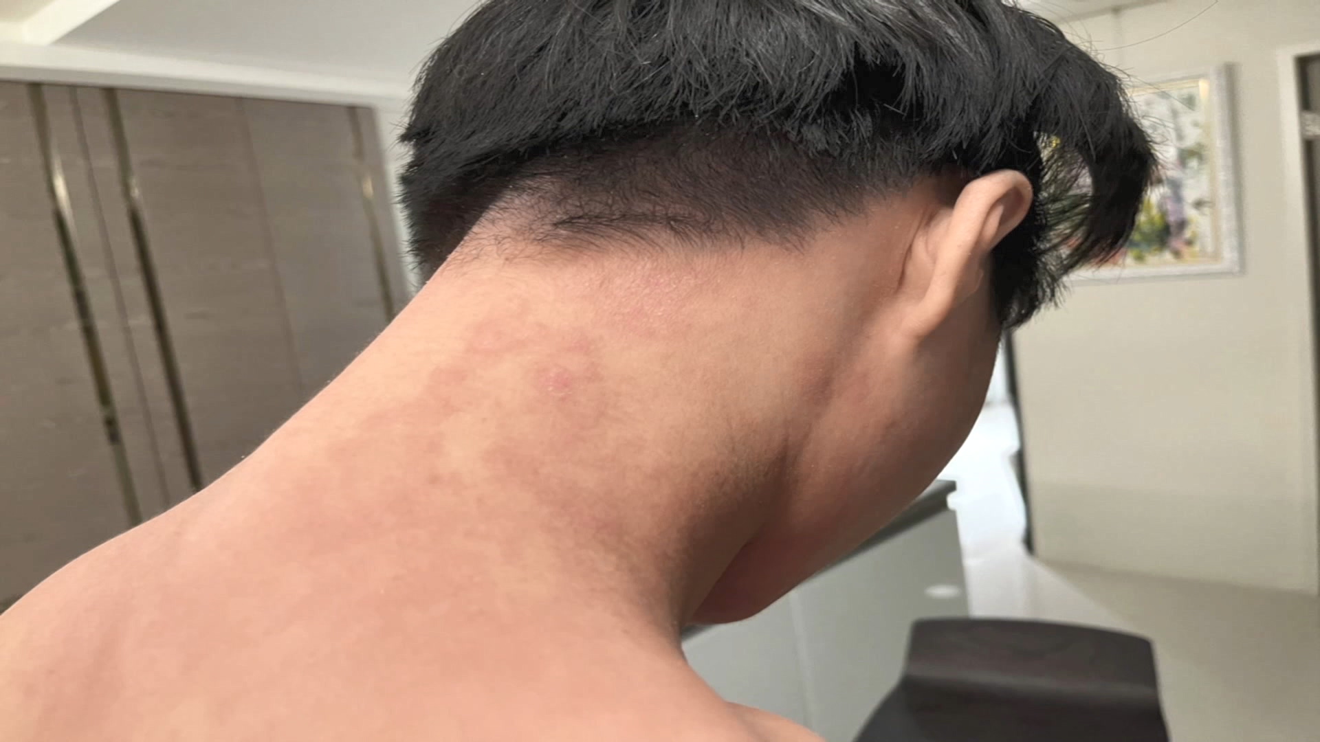 照片授權:北榮醫師 陳志強