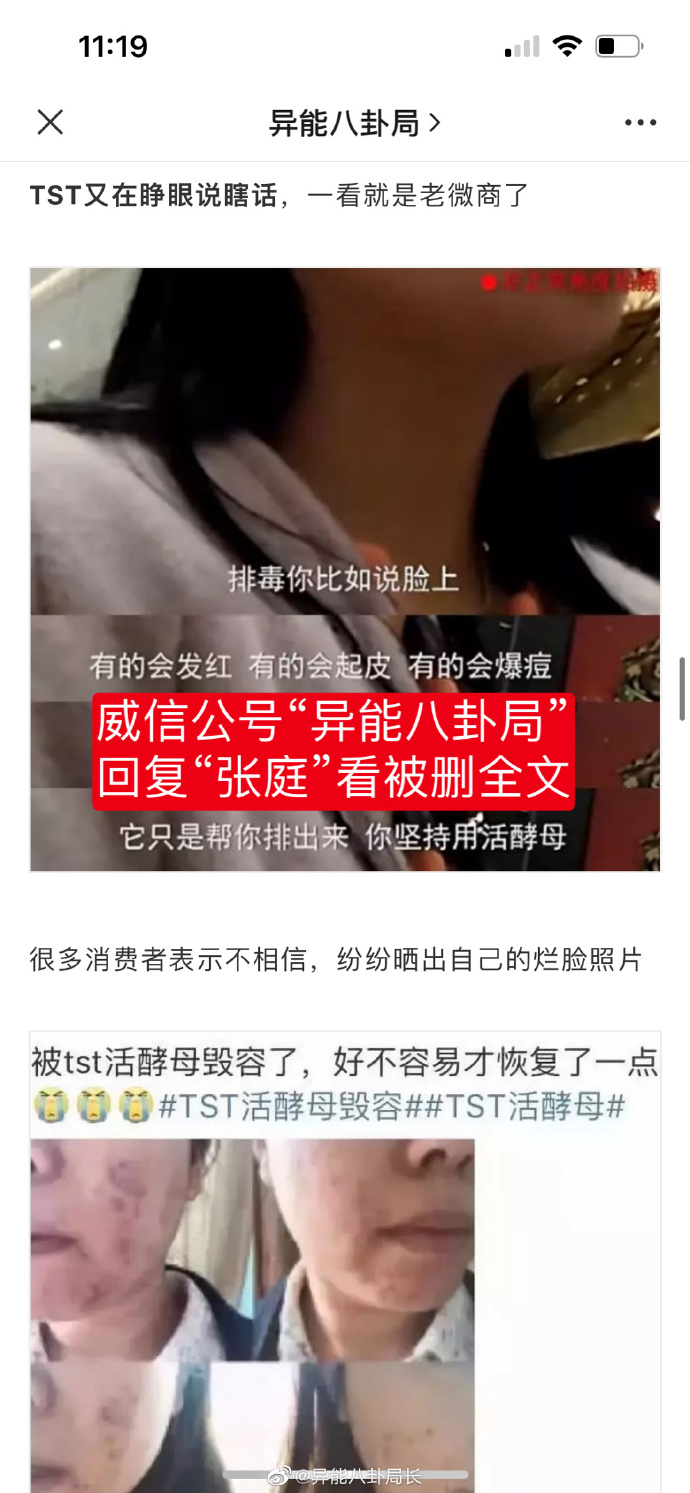 網友挖出張庭夫妻的品牌保養品在2016年曾出問題。（圖／翻攝自微博）