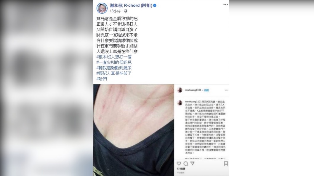 謝和弦當時也發文表示沒有人抓傷Keanna經紀人。(圖/翻攝自謝和弦 臉書)