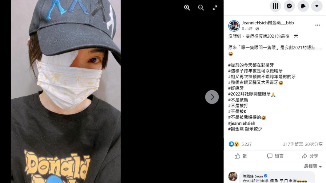 謝金燕曬出受傷照。(圖/翻攝自謝金燕臉書)