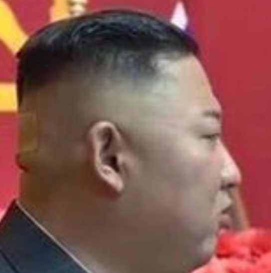 金正恩去(2021)年七月公開露面時,後腦杓相同位置也曾出現貼布,引爆健康疑雲。(圖/翻攝自推特)