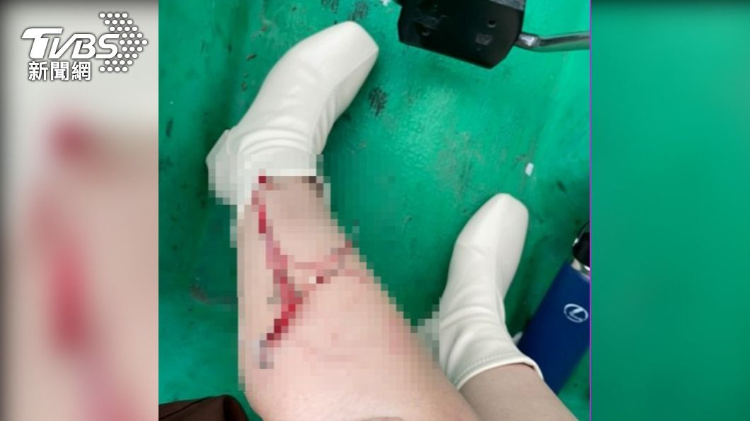 太恐怖!妙齡女碧潭踩天鵝船 竟遭魚鉤「倒鉤」插進小腿