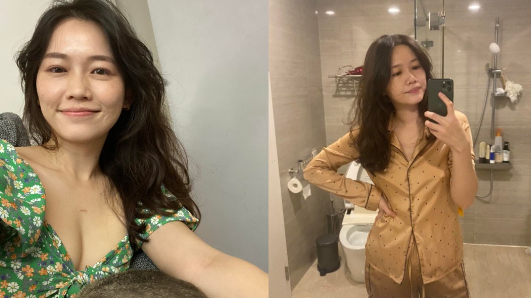 春光外洩?美女醫「胸前點點凸起」 霸氣回:沒有在意