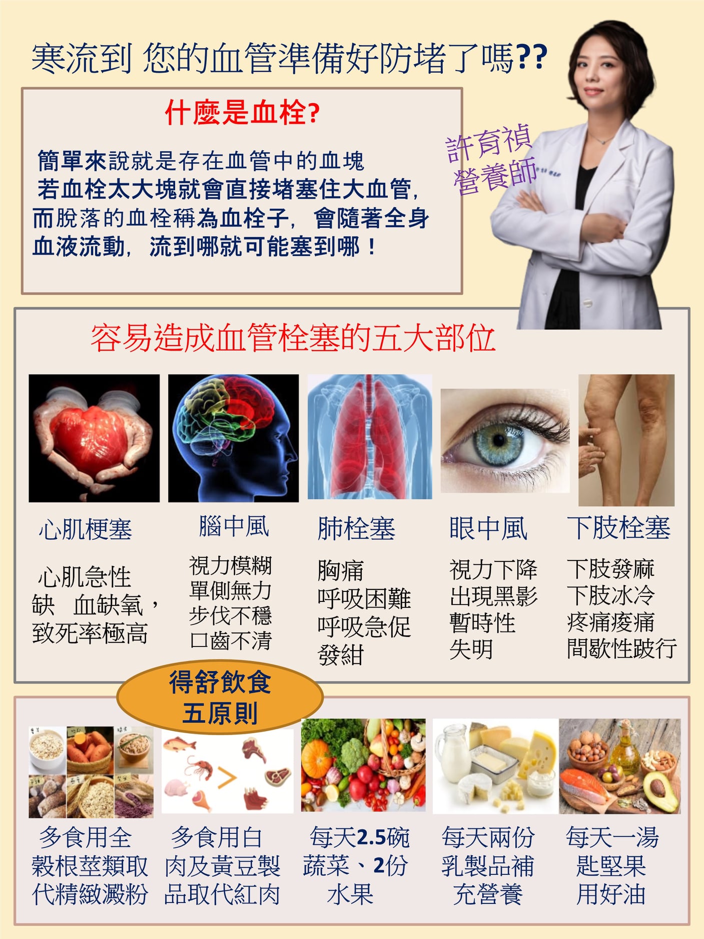 營養師Ivy整理舒飲食五大原則,避免血管栓塞找上門。(圖/翻攝自Ivy營養師的健康教室臉書)