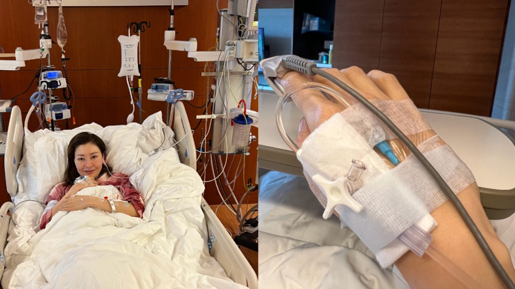 搶命48小時!「最美港姐」李嘉欣送加護 病危畫面曝