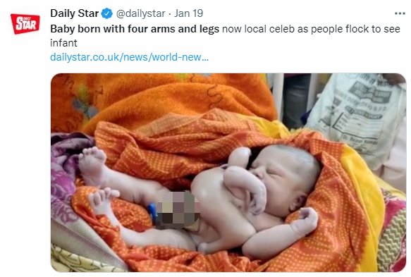 當地人將嬰兒視為神的化身。（圖／翻攝自《Daily Star》）