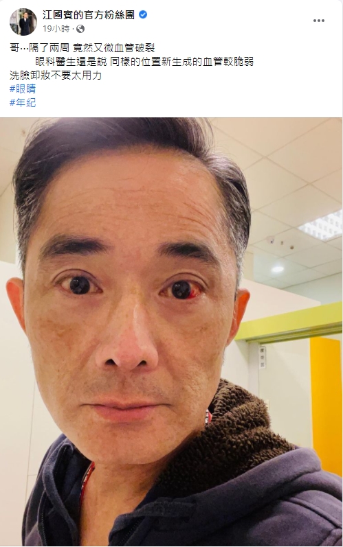 江國賓眼睛微血管再度破裂。(圖/翻攝自江國賓臉書)