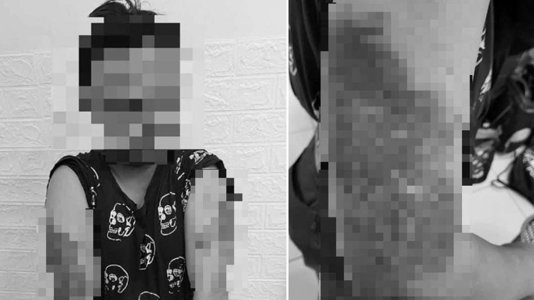 身障男打工養母…1週遭暴打3次！　老闆丟1千5騙和解