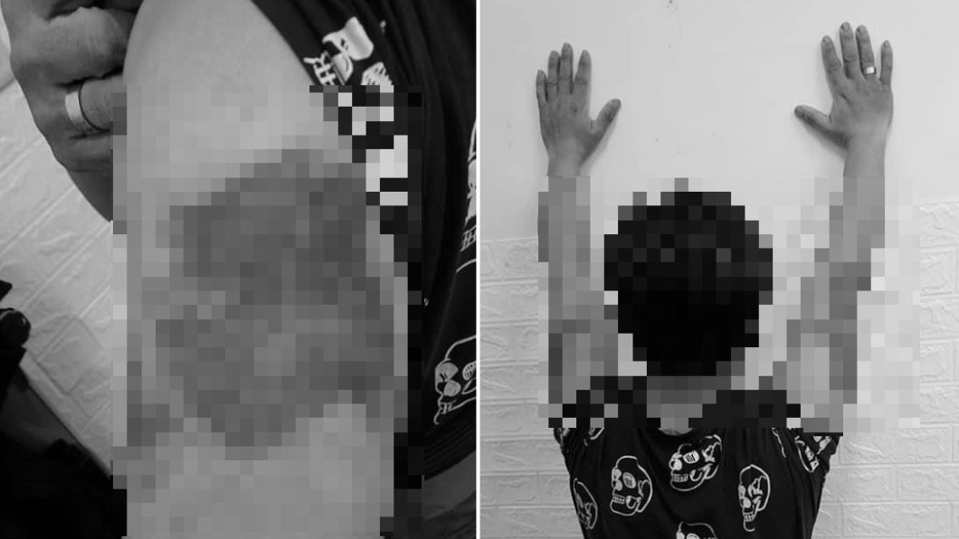 男子被打傷,前往派出所提告傷害。(合成圖/翻攝自爆料公社官網)