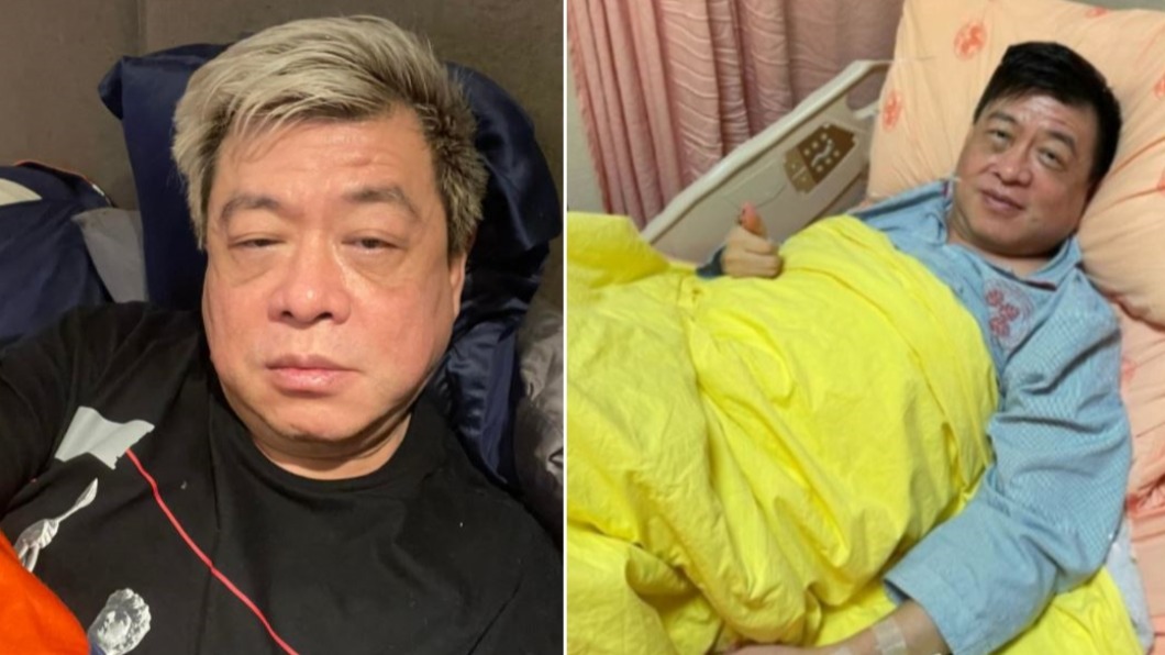 孫德榮痛滾3小時!醫曝「這類食物」晚上別吃:腸胃翻出來