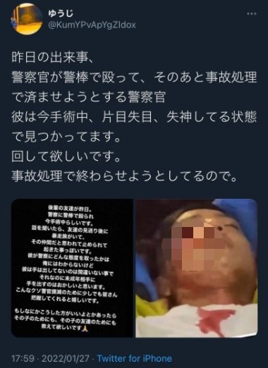 網傳「少年遭警棍毆打致失明」。(圖/翻攝自@KumYPvApYgZldox推特)