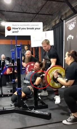 瑪茶朵的左手臂應聲折斷。(圖/翻攝自powerlifting_portagee TikTok)