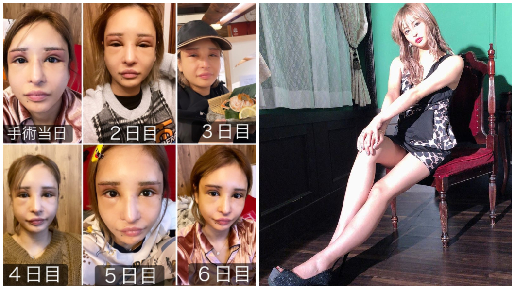 櫻井野之花和大方分享自己整形前後的對比照。(合程圖/翻攝自IGnonoka199148_sub)