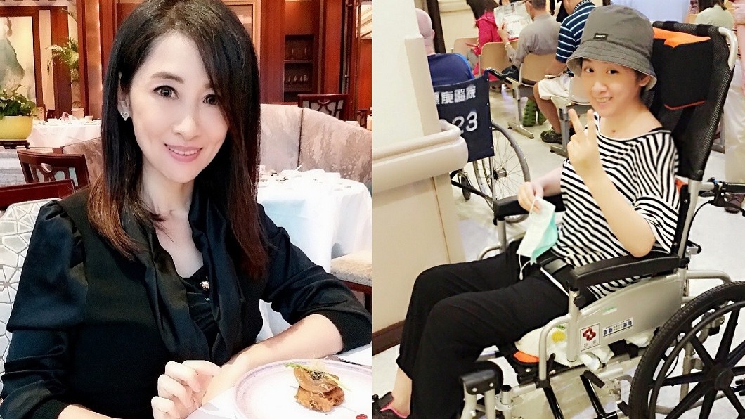 昔腦溢血返台接頭蓋骨!美女主播「從頭學說話」近況曝