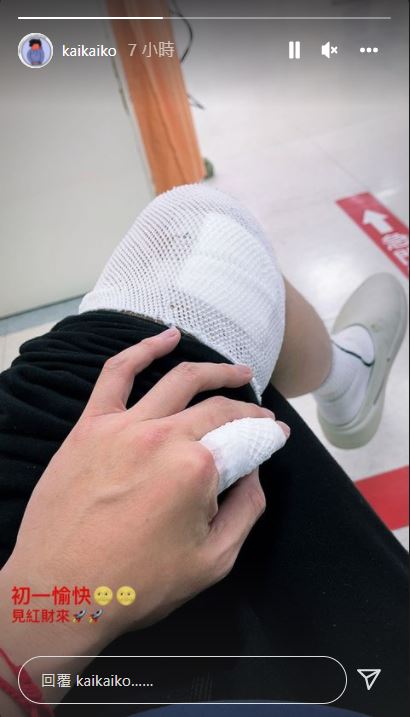 柯震東手腳都受傷了。(圖/翻攝自柯震東IG)