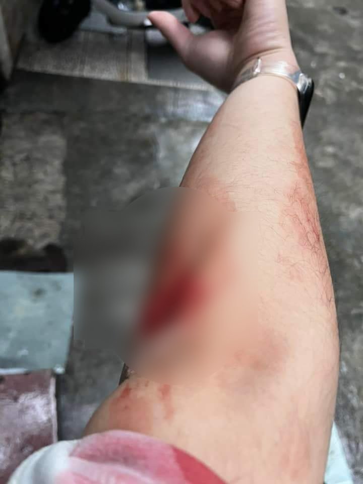 被害人手遭劃傷並到醫院縫針。圖/翻攝爆料公社