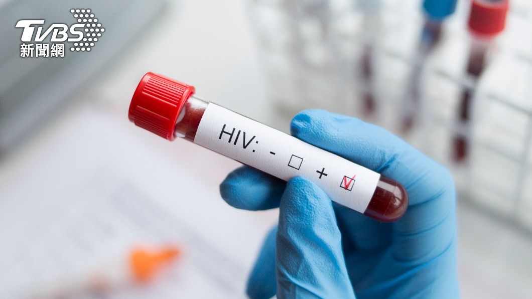 HIV也有可能造成肝掌。(示意圖,非當事人/shutterstock達志影像)
