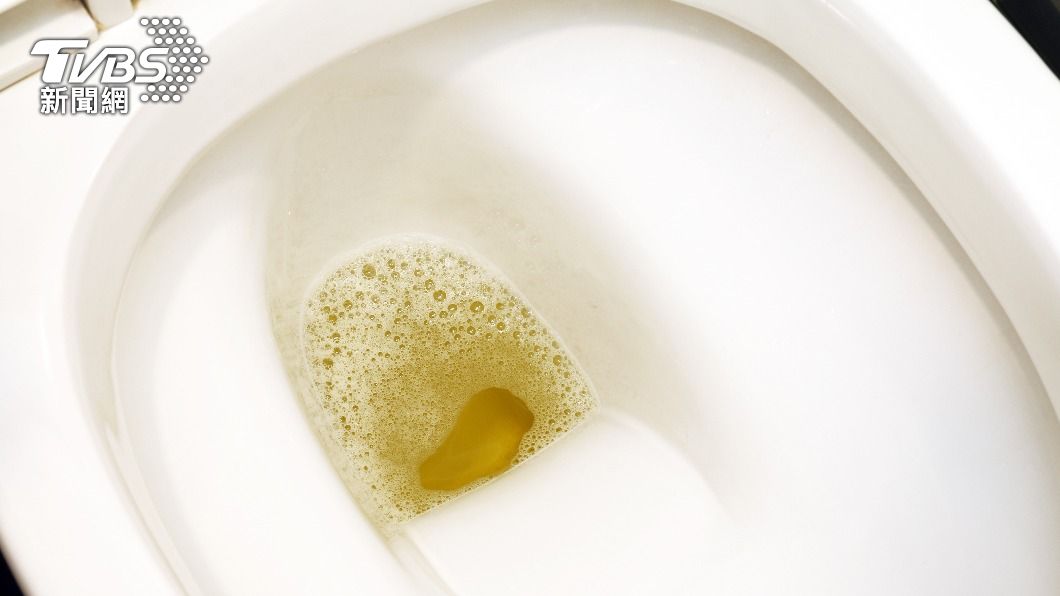膀胱癌的危險信號是「尿液」。（示意圖／shutterstock達志影像）