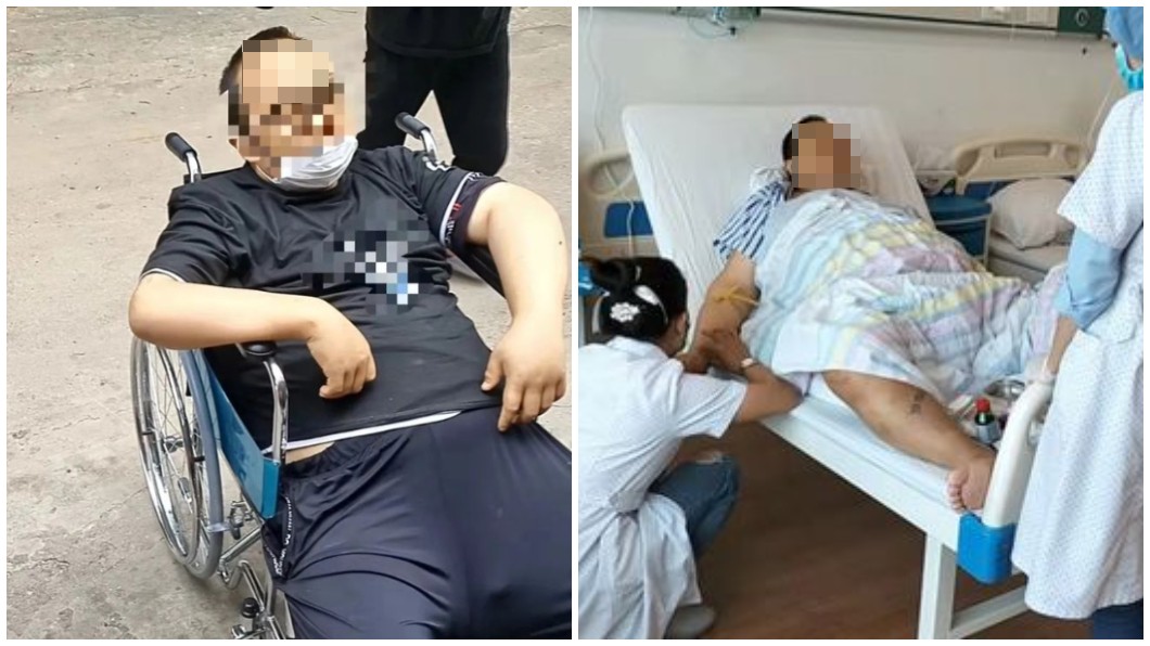 男子被救出時全身浮腫且身上布滿密密麻麻的針孔。(合成圖/翻攝自上游新聞)