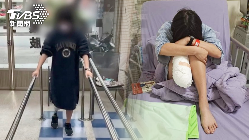苗栗遭截肢包裝工　業者允保障醫療後回任