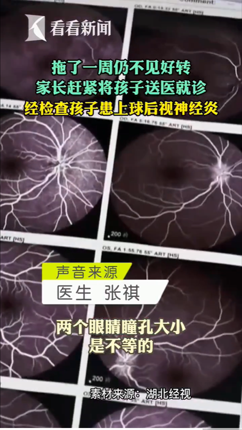 醫師診斷發現女童罹患「球後視神經炎」。(圖/翻攝自看看新聞)