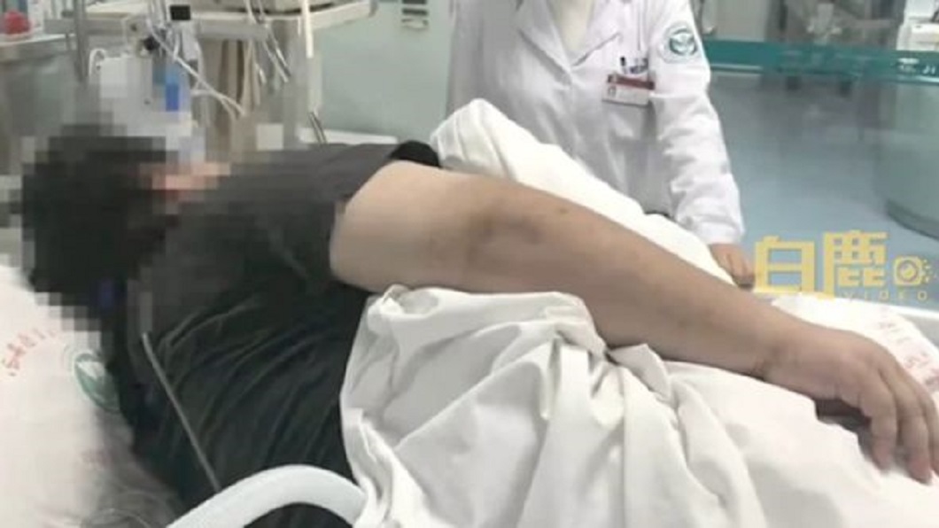 西安一名男子一天只吃一餐但體重卻胖到130公斤。(圖/翻攝自白鹿視頻)
