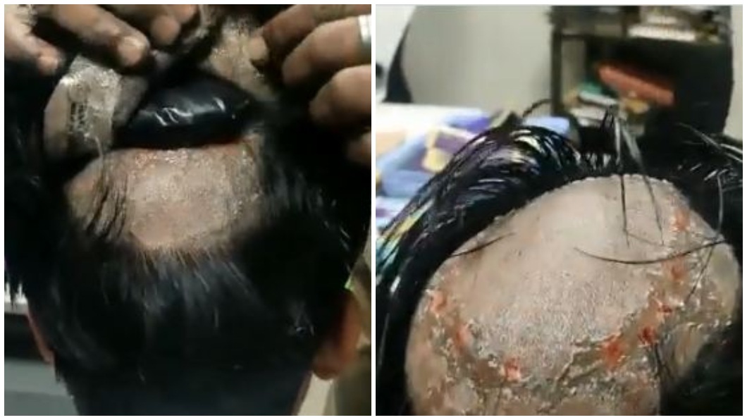男子把黃金熔化後裝袋黏在假髮下。（圖／翻攝自推特Mukesh singh sengar मुकेश सिंह सेंगर @mukeshmukeshs）