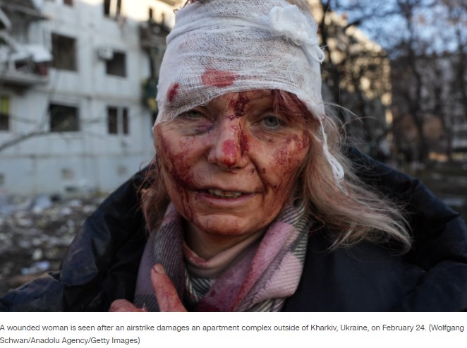 烏克蘭無名婦受傷的照片被各大外媒引用。（圖／翻攝自《CNN》）