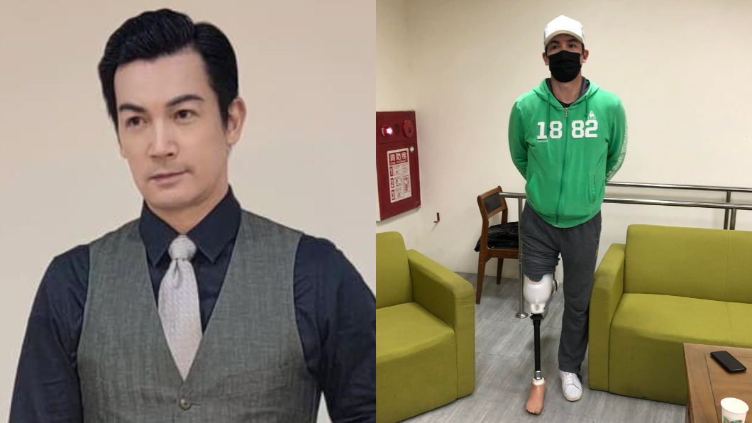 伊正無預警公開「截肢照」嘆:忍著痛 粉絲驚:怎會這樣