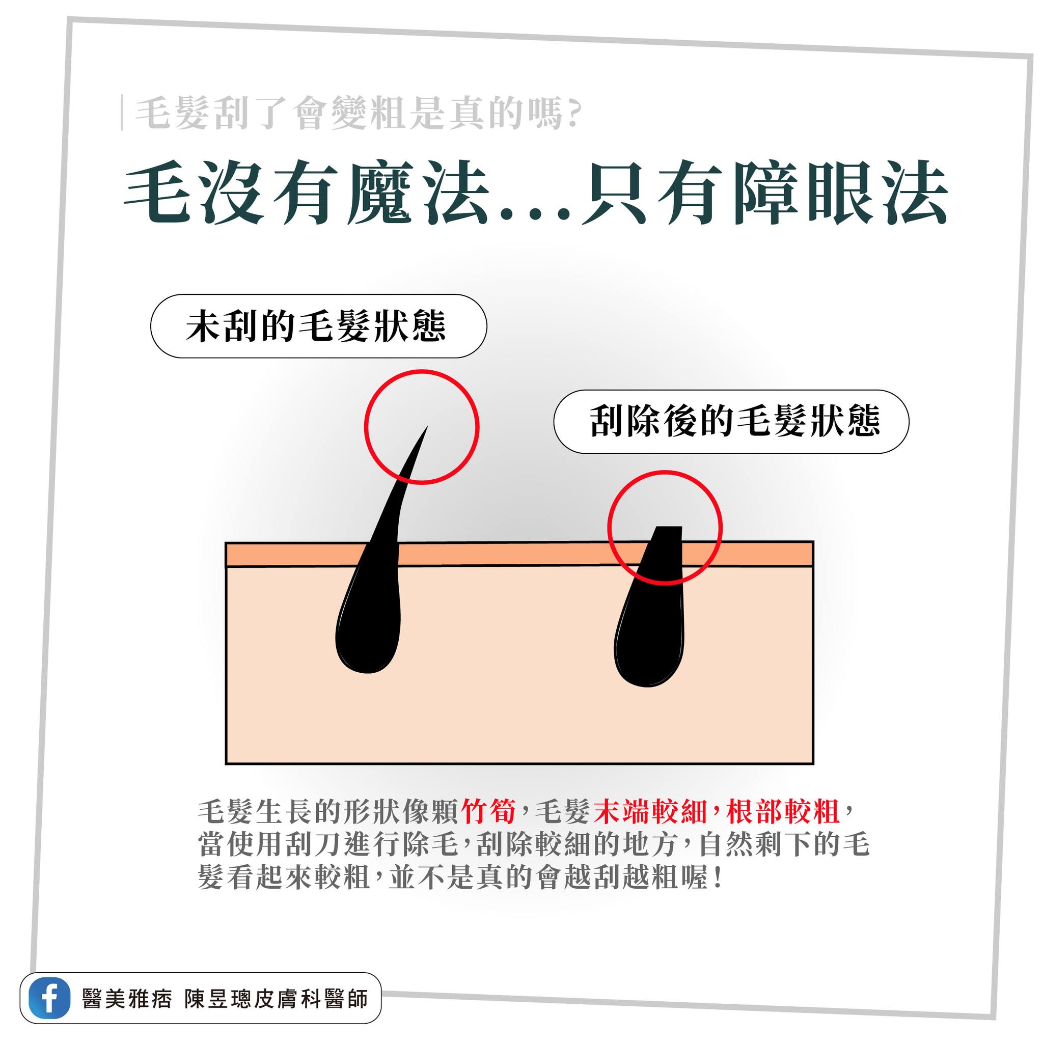 陳昱璁指出,毛不會越刮越粗。(圖/翻攝自陳昱璁臉書)