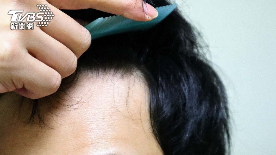 常用髮膠易禿頭?專家破迷思 做好「3步驟」無後顧之憂