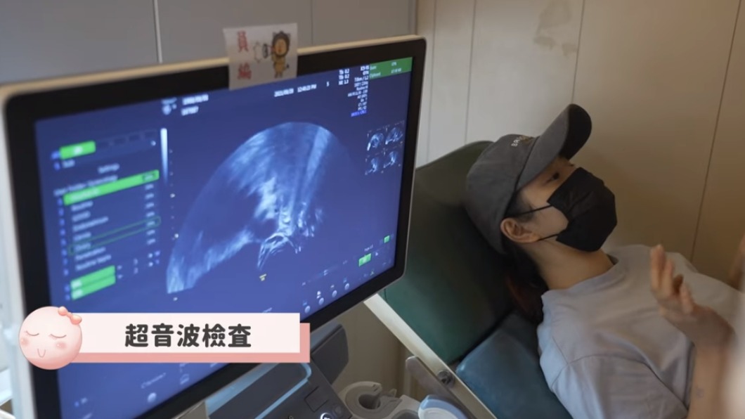 劉品言曬出超音波照。(圖/翻攝自YouTube劉品言官方專屬頻道)