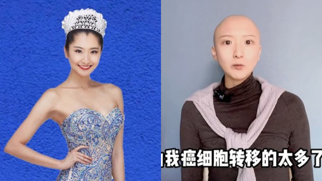 28歲網紅胃癌病逝！8類人風險最高　晚期恐怖5症狀曝