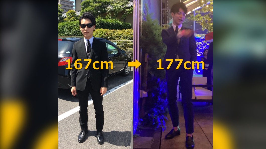 日型男砸百萬動骨骼延長手術 167變真正「高富帥」