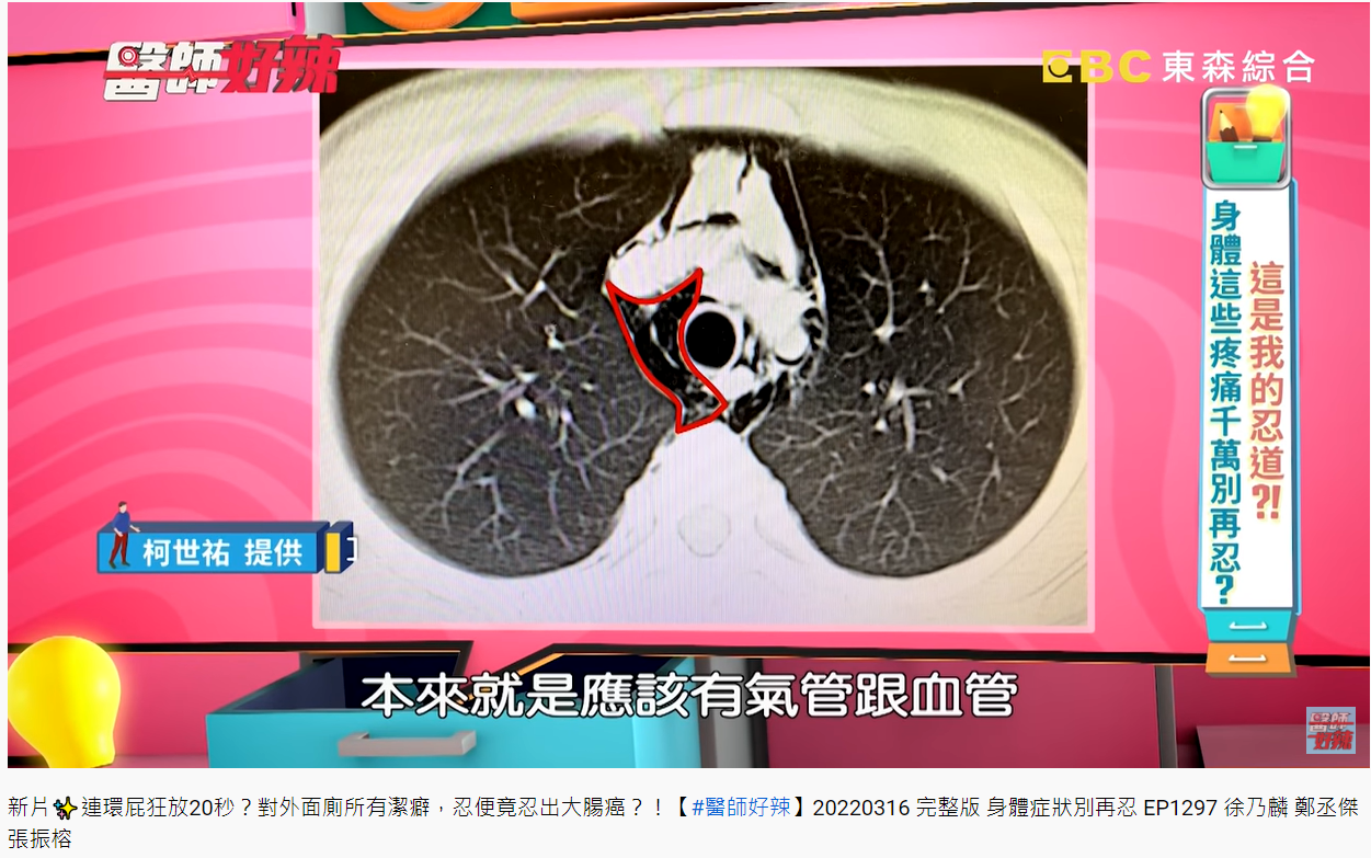 急診科醫師柯世祐解釋,空氣跑到皮下、縱膈腔。(圖/翻攝自醫師好辣YouTube)