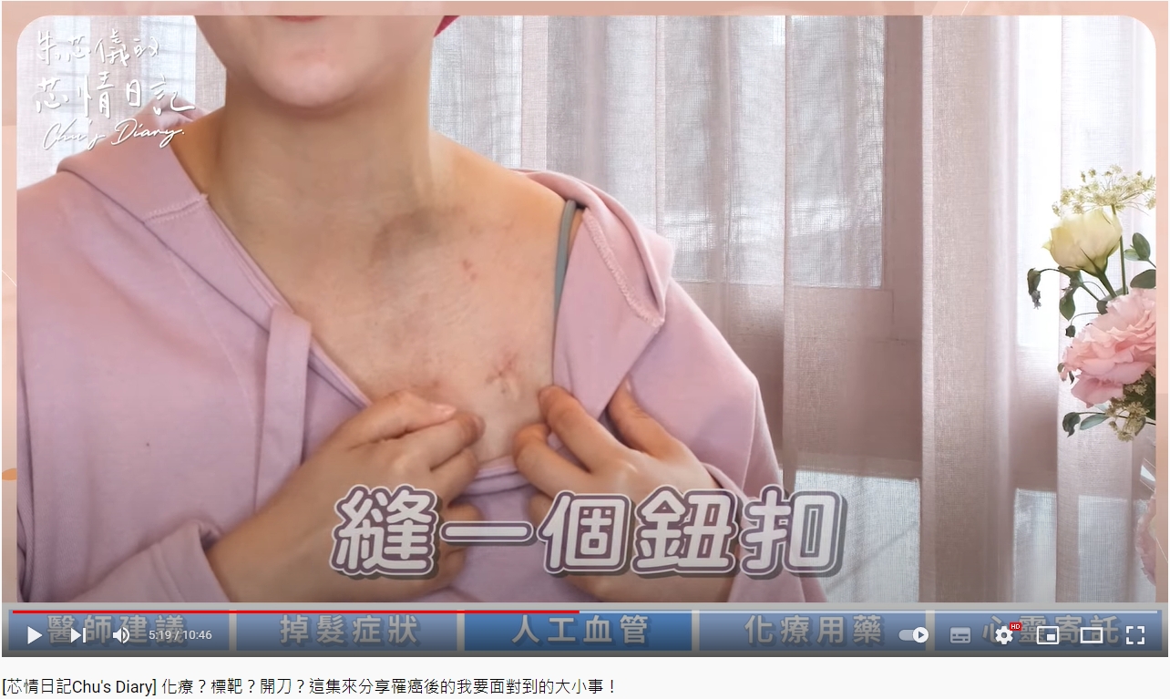 朱芯儀秀出自己的人工血管。(圖/翻攝自朱芯儀YouTube)