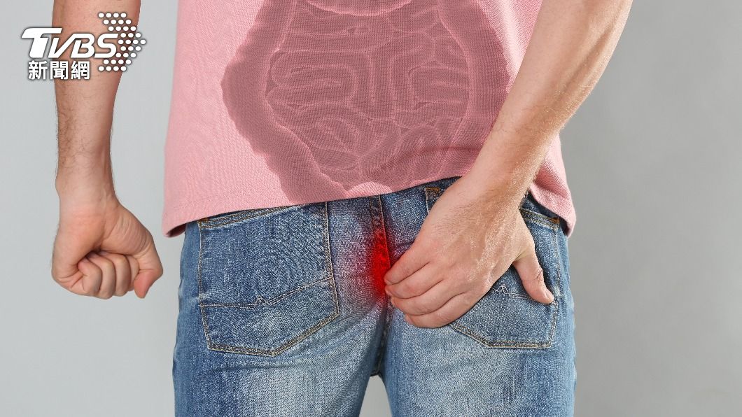 手術是最能一勞永逸根治肛門瘻管的方式。（示意圖／shutterstock達志影像）