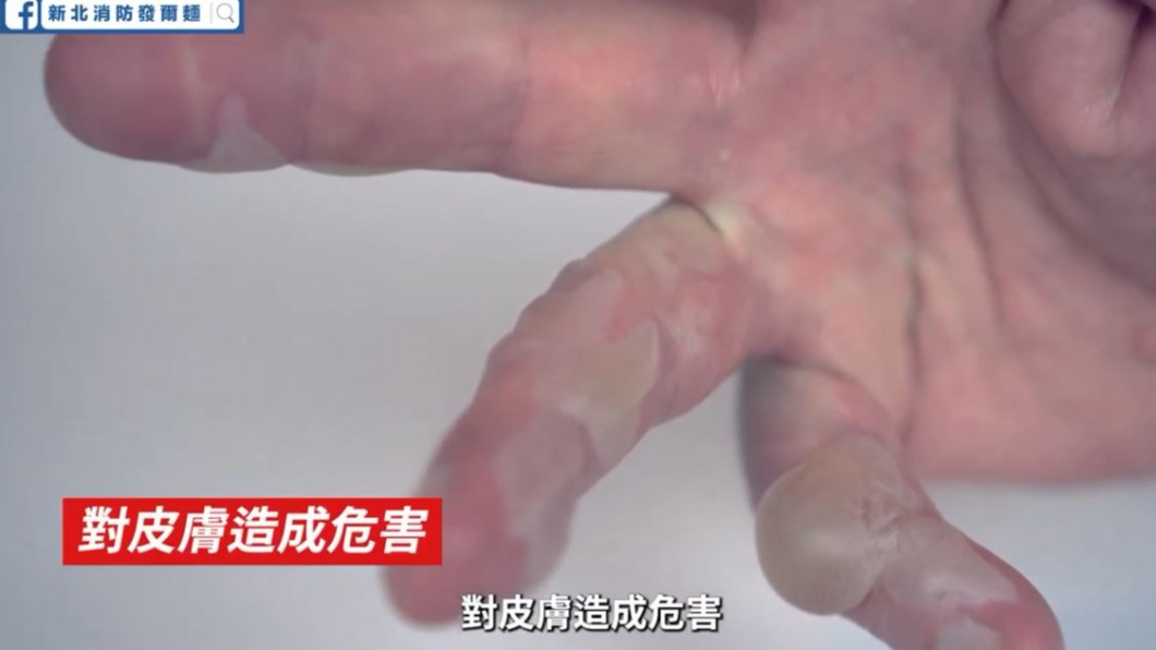 有毒氣體可能侵蝕皮膚。（圖／新北市消防局提供）