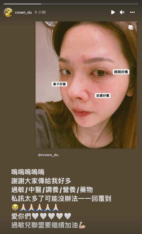 滴妹喊話其他過敏兒一起加油。(圖/翻攝自滴妹IG)