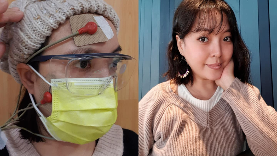 女星爆面癱!醫警告「3成恐留後遺症」復健方式曝光